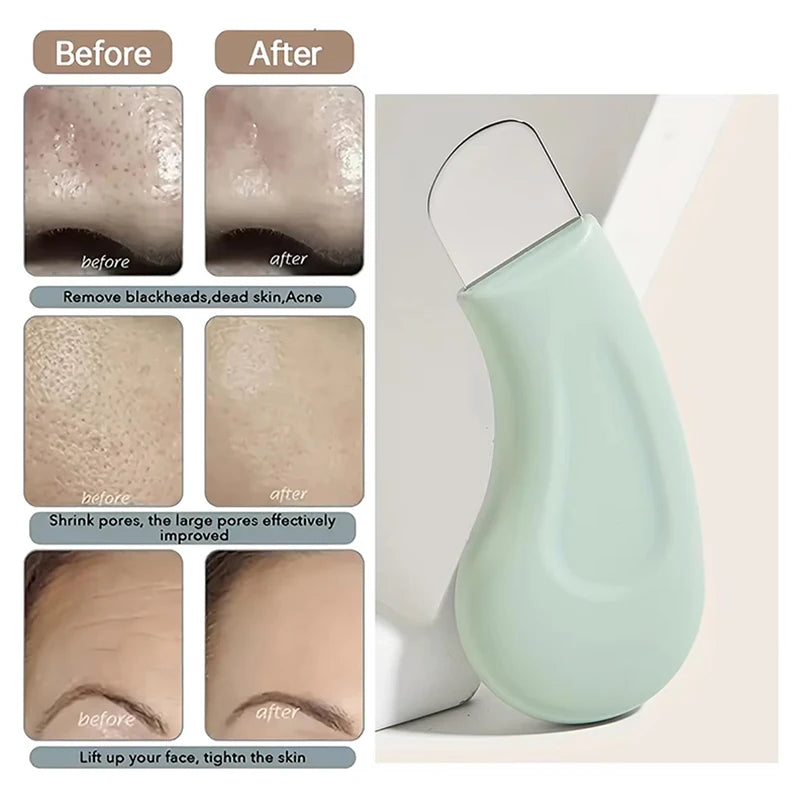 Deep Cleansing Facial Blackhead Whitehead Removal Tool Nose Remove Whitehead Acne Handheld Pore Cleaner Beauty Care Tool