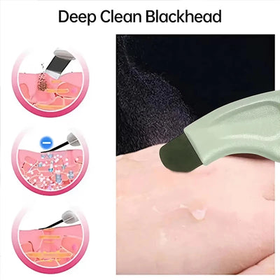Deep Cleansing Facial Blackhead Whitehead Removal Tool Nose Remove Whitehead Acne Handheld Pore Cleaner Beauty Care Tool