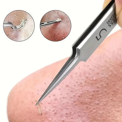Easy-To-Use Stainless Steel Acne Extractor Set - Hypoallergenic Beauty Tweezers For Clear Skin, Perfect For Beginners